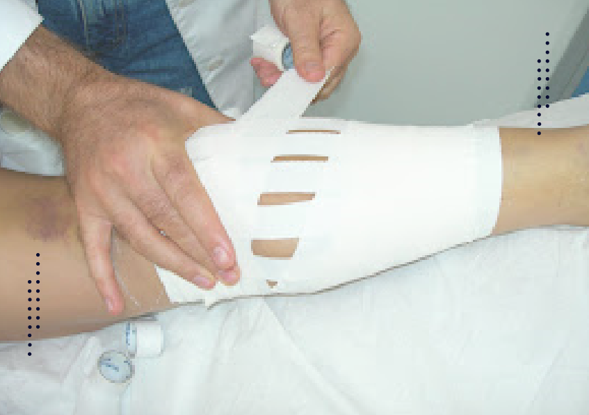 Ligaduras-FUncionais-Curso-01